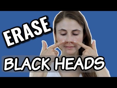 Erase blackheads: dermatologist tips| Dr Dray